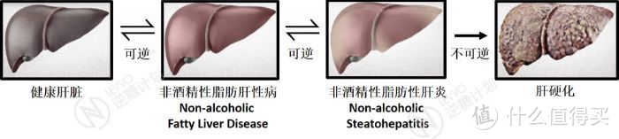 中年男人最常见的疾病之一的脂肪肝,我是怎样通过锻炼治愈的